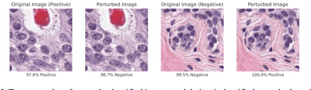 Figure 1 for Now You See It, Now You Dont: Adversarial Vulnerabilities in Computational Pathology