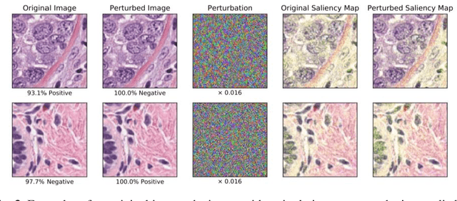 Figure 4 for Now You See It, Now You Dont: Adversarial Vulnerabilities in Computational Pathology