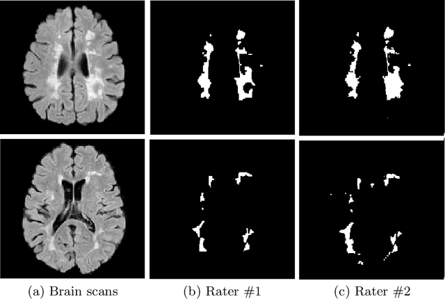 Figure 1 for The Impact of an Inter-rater Bias on Neural Network Training