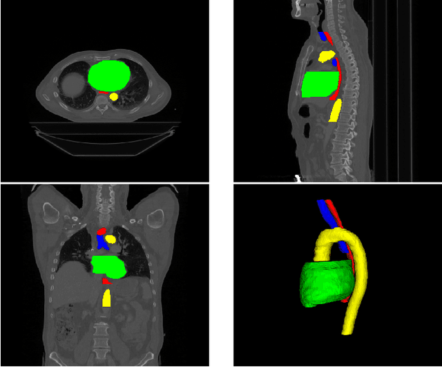 Figure 1 for A 2D dilated residual U-Net for multi-organ segmentation in thoracic CT