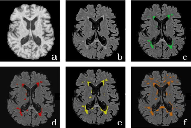 Figure 3 for Transfer Learning for Domain Adaptation in MRI: Application in Brain Lesion Segmentation