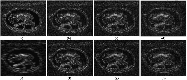 Figure 2 for Reconstruction of Enhanced Ultrasound Images From Compressed Measurements Using Simultaneous Direction Method of Multipliers