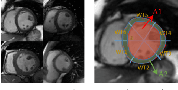 Figure 3 for Direct Multitype Cardiac Indices Estimation via Joint Representation and Regression Learning