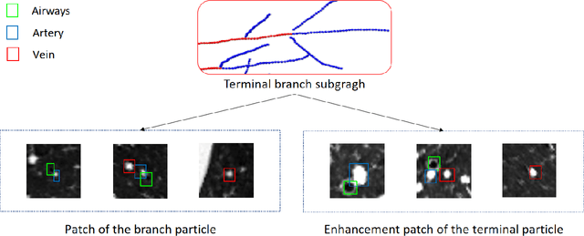 Figure 3 for Automatic Pulmonary Artery and Vein Separation Algorithm Based on Multitask Classification Network and Topology Reconstruction in Chest CT Images