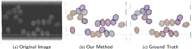 Figure 4 for Joint Cell Nuclei Detection and Segmentation in Microscopy Images Using 3D Convolutional Networks