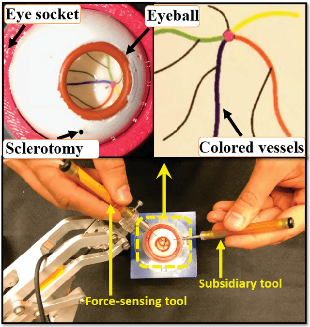 Figure 1 for Sclera Force Control in Robot-assisted Eye Surgery: Adaptive Force Control vs. Auditory Feedback