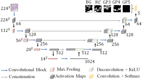 Figure 3 for Gleason Grading of Histology Prostate Images through Semantic Segmentation via Residual U-Net