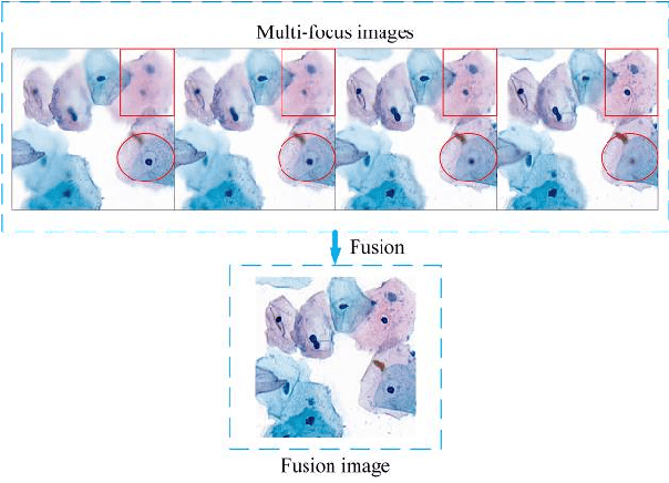 Figure 1 for FFusionCGAN: An end-to-end fusion method for few-focus images using conditional GAN in cytopathological digital slides