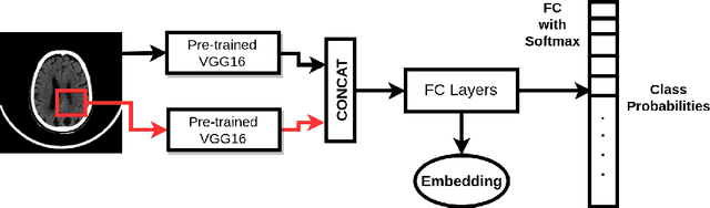 Figure 1 for Anatomical labeling of brain CT scan anomalies using multi-context nearest neighbor relation networks