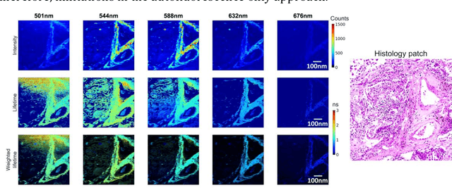 Figure 1 for Deep Learning-Assisted Co-registration of Full-Spectral Autofluorescence Lifetime Microscopic Images with H&E-Stained Histology Images