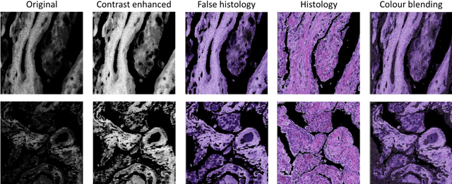 Figure 4 for Deep Learning-Assisted Co-registration of Full-Spectral Autofluorescence Lifetime Microscopic Images with H&E-Stained Histology Images