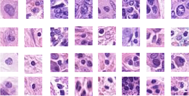 Figure 2 for RCCNet: An Efficient Convolutional Neural Network for Histological Routine Colon Cancer Nuclei Classification