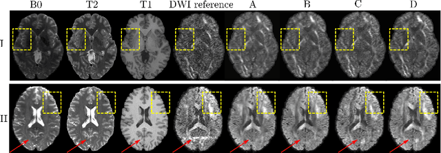 Figure 3 for Q-space Conditioned Translation Networks for Directional Synthesis of Diffusion Weighted Images from Multi-modal Structural MRI