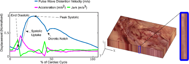 Figure 1 for Higher Order of Motion Magnification for Vessel Localisation in Surgical Video