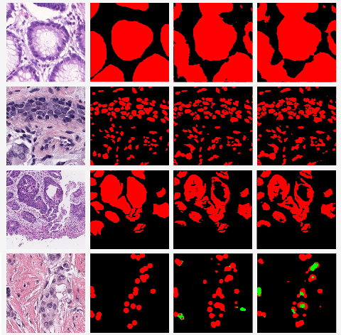 Figure 3 for MetaHistoSeg: A Python Framework for Meta Learning in Histopathology Image Segmentation