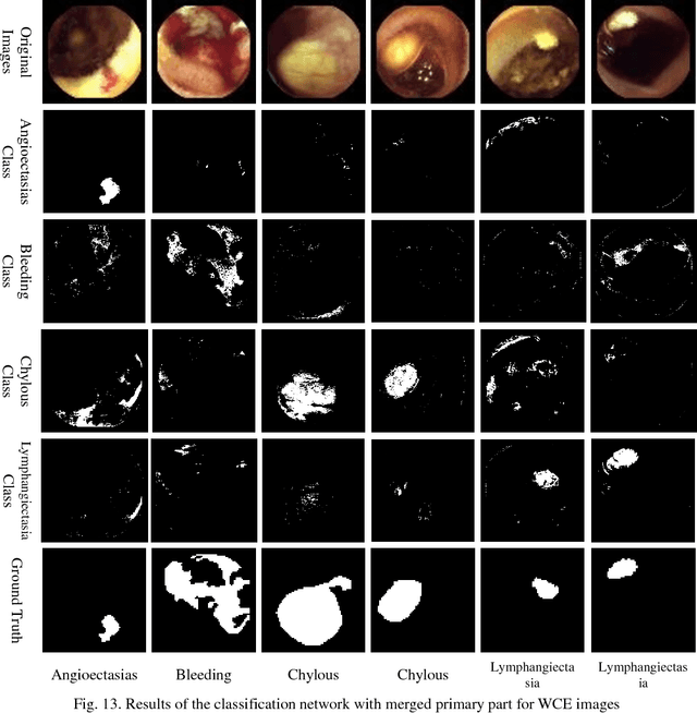 Figure 4 for Multiple Abnormality Detection for Automatic Medical Image Diagnosis Using Bifurcated Convolutional Neural Network