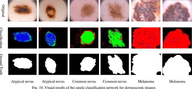 Figure 2 for Multiple Abnormality Detection for Automatic Medical Image Diagnosis Using Bifurcated Convolutional Neural Network