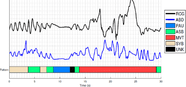 Figure 1 for Predicting Extubation Readiness in Extreme Preterm Infants based on Patterns of Breathing