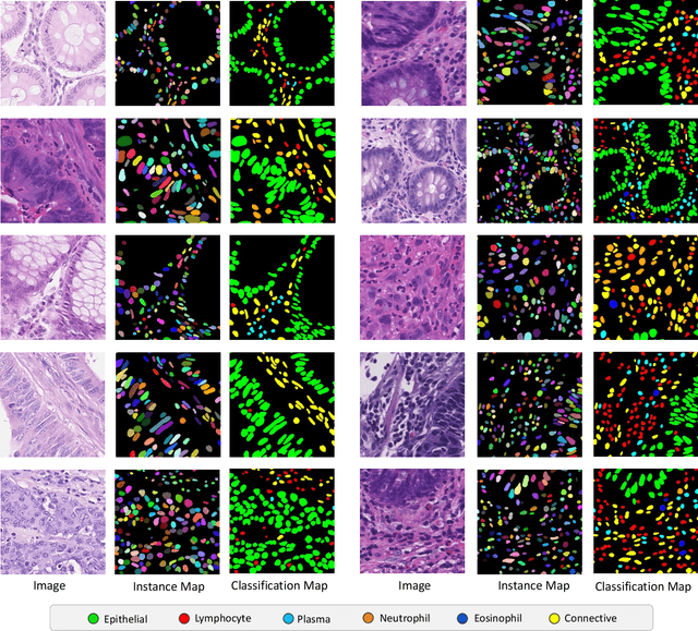 Figure 2 for CoNIC: Colon Nuclei Identification and Counting Challenge 2022