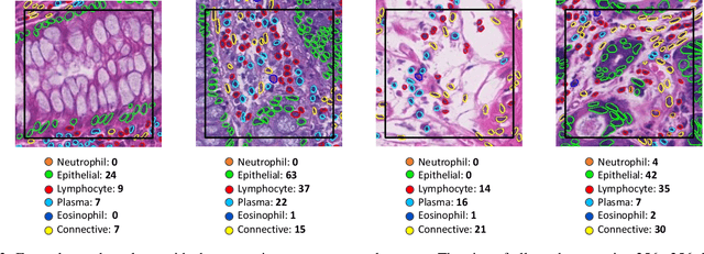 Figure 3 for CoNIC: Colon Nuclei Identification and Counting Challenge 2022