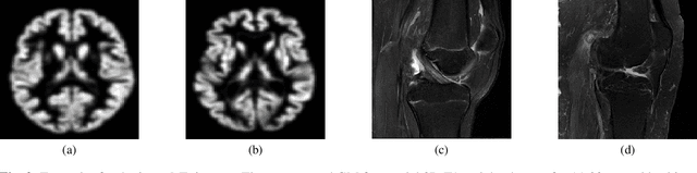 Figure 3 for Organ-based Age Estimation based on 3D MRI Scans