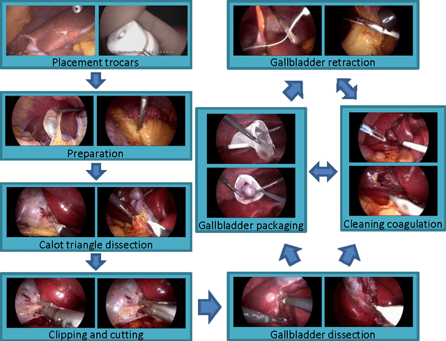 Figure 1 for Single- and Multi-Task Architectures for Surgical Workflow Challenge at M2CAI 2016