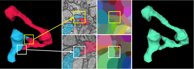 Figure 3 for Learning Dense Voxel Embeddings for 3D Neuron Reconstruction