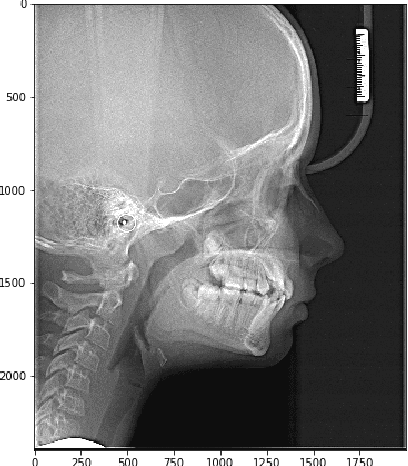 Figure 1 for The efficiency of deep learning algorithms for detecting anatomical reference points on radiological images of the head profile