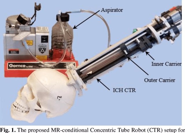 Figure 1 for A Surgical Platform for Intracerebral Hemorrhage Robotic Evacuation (ASPIHRE): A Non-metallic MR-guided Concentric Tube Robot