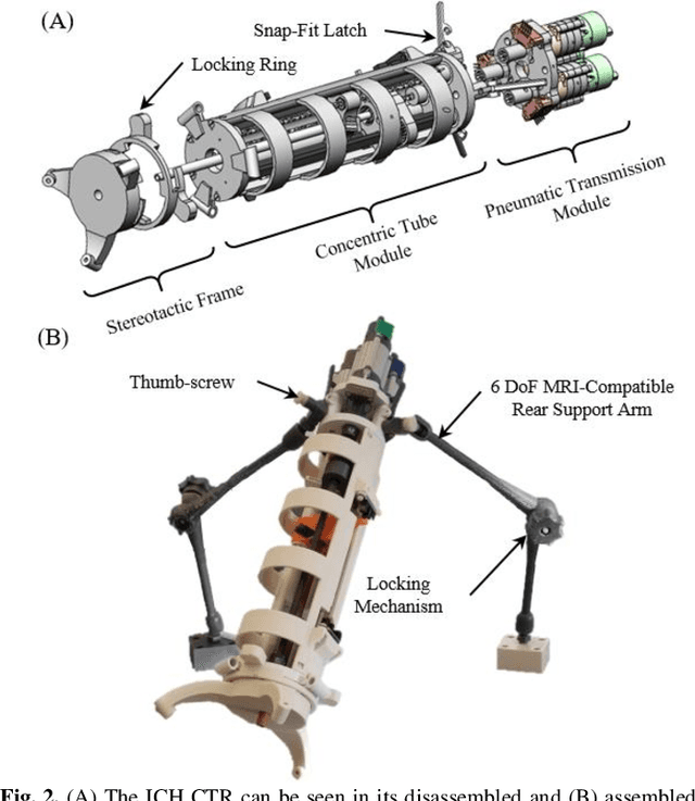 Figure 3 for A Surgical Platform for Intracerebral Hemorrhage Robotic Evacuation (ASPIHRE): A Non-metallic MR-guided Concentric Tube Robot
