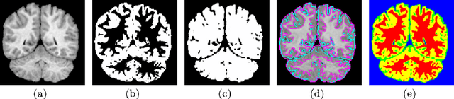 Figure 1 for Brain MRI Segmentation with Fast and Globally Convex Multiphase Active Contours