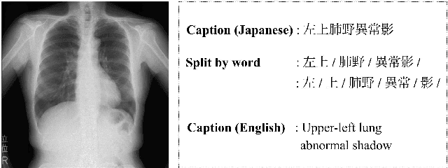 Figure 1 for Character-level Japanese Text Generation with Attention Mechanism for Chest Radiography Diagnosis