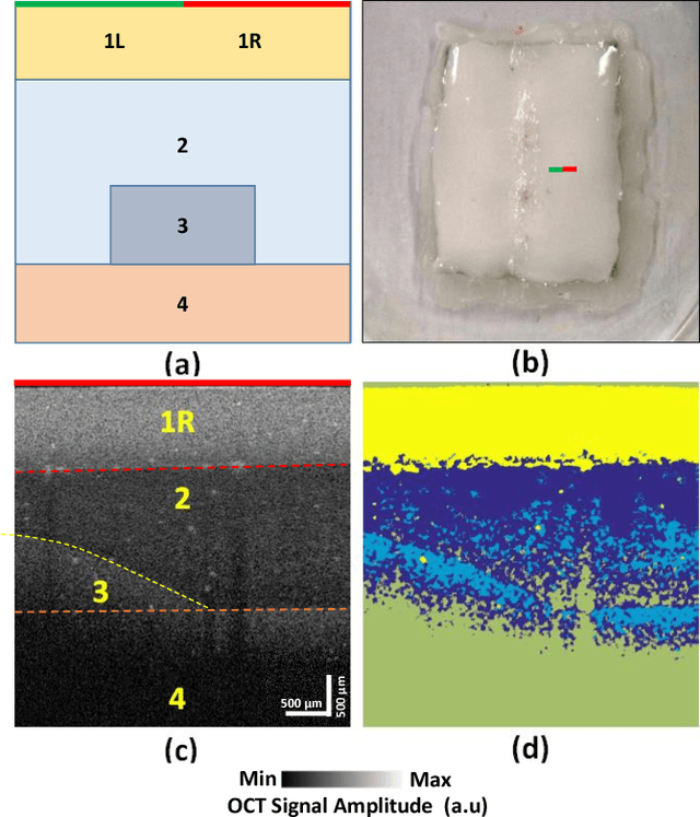 Figure 2 for An Adaptive Cluster-based Filtering Framework for Speckle Reduction of OCT Skin Images