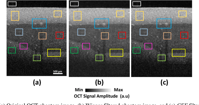 Figure 4 for An Adaptive Cluster-based Filtering Framework for Speckle Reduction of OCT Skin Images