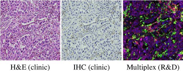 Figure 1 for DeepLIIF: An Online Platform for Quantification of Clinical Pathology Slides