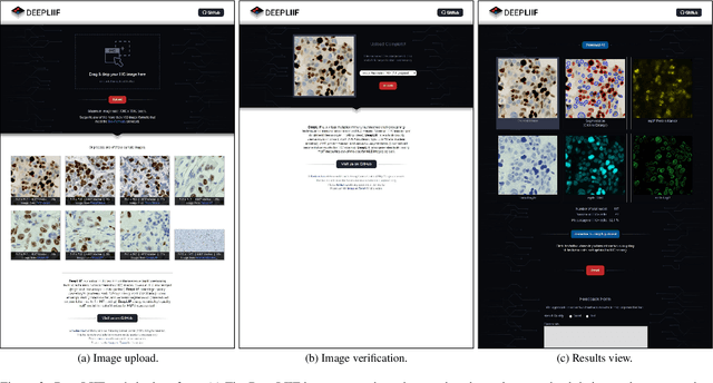 Figure 3 for DeepLIIF: An Online Platform for Quantification of Clinical Pathology Slides