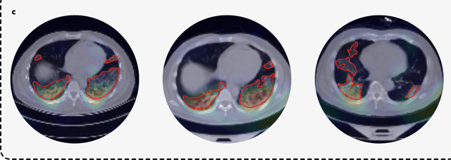 Figure 3 for Advancing COVID-19 Diagnosis with Privacy-Preserving Collaboration in Artificial Intelligence