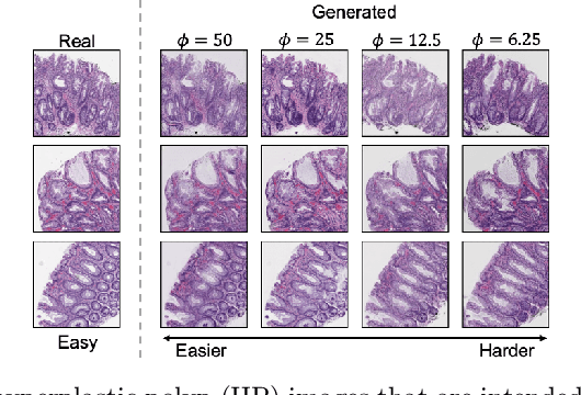 Figure 1 for Difficulty Translation in Histopathology Images