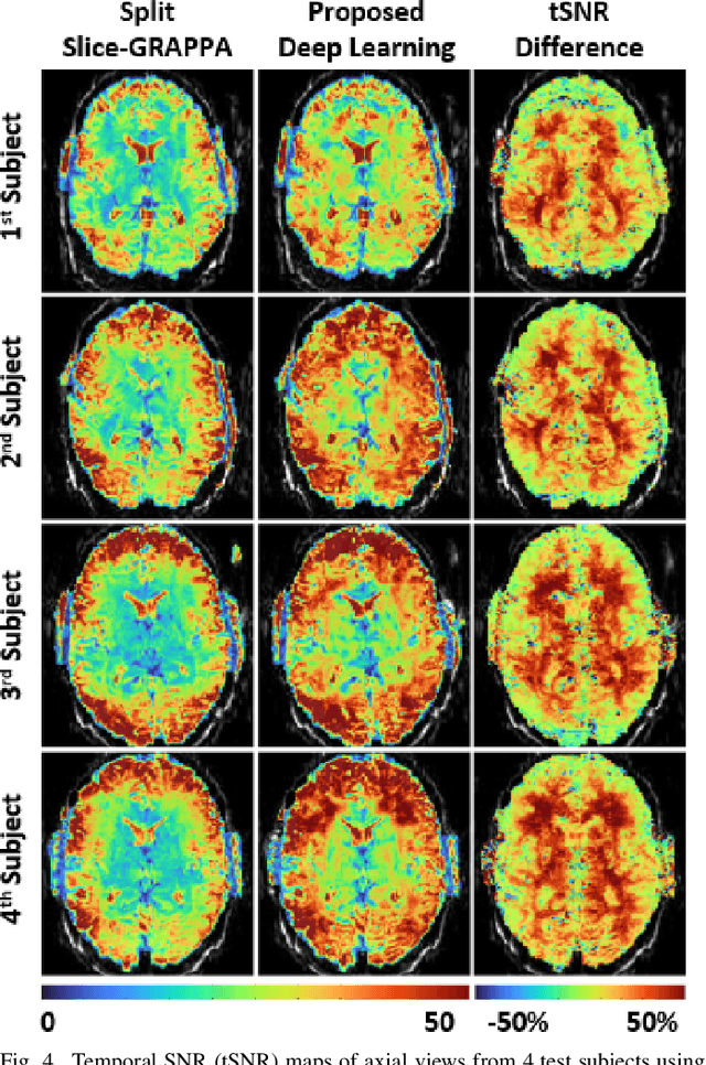 Figure 4 for Improved Simultaneous Multi-Slice Functional MRI Using Self-supervised Deep Learning