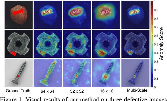 Figure 1 for Student-Teacher Feature Pyramid Matching for Unsupervised Anomaly Detection