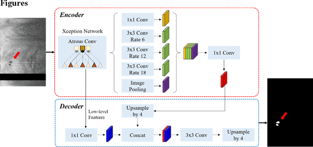 Figure 1 for Automated segmentation of microvessels in intravascular OCT images using deep learning