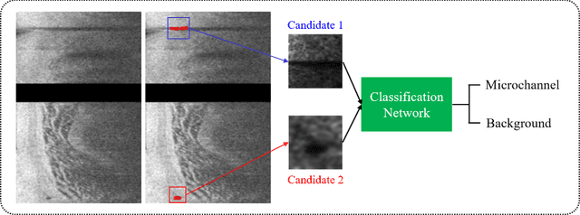 Figure 3 for Automated segmentation of microvessels in intravascular OCT images using deep learning