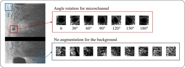 Figure 4 for Automated segmentation of microvessels in intravascular OCT images using deep learning