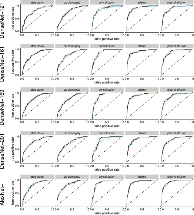 Figure 4 for Comparing Different Deep Learning Architectures for Classification of Chest Radiographs