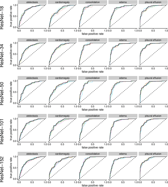 Figure 2 for Comparing Different Deep Learning Architectures for Classification of Chest Radiographs