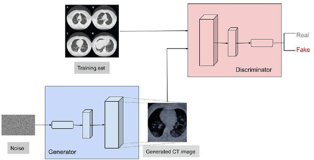 Figure 3 for Generation of COVID-19 Chest CT Scan Images using Generative Adversarial Networks