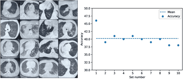 Figure 4 for Generation of COVID-19 Chest CT Scan Images using Generative Adversarial Networks