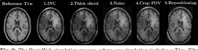 Figure 3 for Groupwise Multimodal Image Registration using Joint Total Variation