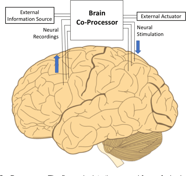Figure 1 for Brain Co-Processors: Using AI to Restore and Augment Brain Function