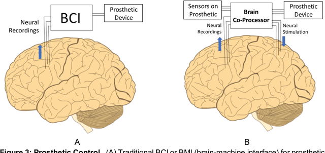 Figure 4 for Brain Co-Processors: Using AI to Restore and Augment Brain Function